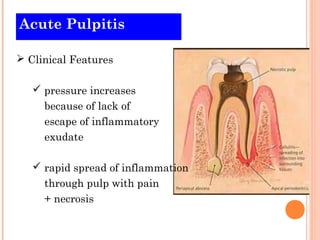 Acute Pulpitis

 Clinical Features

    pressure increases
     because of lack of
     escape of inflammatory
     exudate

    rapid spread of inflammation
     through pulp with pain
     + necrosis
 