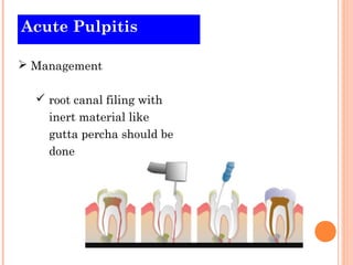 Acute Pulpitis

 Management

   root canal filing with
    inert material like
    gutta percha should be
    done
 