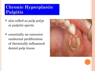 Chronic Hyperplastic
Pulpitis
 also called as pulp polyp
  or pulpitis aperta

 essentially an excessive
  exuberant proliferation
  of chronically inflammed
  dental pulp tissue
 