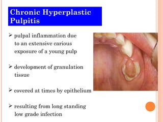 Chronic Hyperplastic
Pulpitis
 pulpal inflammation due
  to an extensive carious
  exposure of a young pulp

 development of granulation
  tissue

 covered at times by epithelium

 resulting from long standing
  low grade infection
 