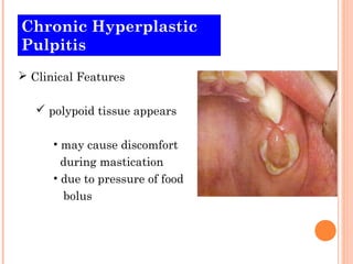 Chronic Hyperplastic
Pulpitis
 Clinical Features

    polypoid tissue appears

      • may cause discomfort
        during mastication
      • due to pressure of food
        bolus
 