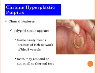 Chronic Hyperplastic
Pulpitis
 Clinical Features

    polypoid tissue appears

      • tissue easily bleeds
        because of rich network
        of blood vessels

      • tooth may respond or
       not at all to thermal test
 