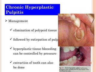 Chronic Hyperplastic
Pulpitis
 Management

   elimination of polypoid tissue

   followed by extirpation of pulp

   hyperplastic tissue bleeeding
    can be controlled by pressure

   extraction of tooth can also
    be done
 