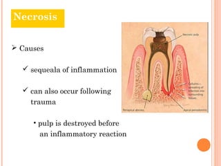 Necrosis


 Causes

   sequeala of inflammation

   can also occur following
    trauma

     • pulp is destroyed before
       an inflammatory reaction
 