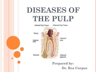 DISEASES OF
 THE PULP




     Prepared by:
          Dr. Rea Corpuz
 