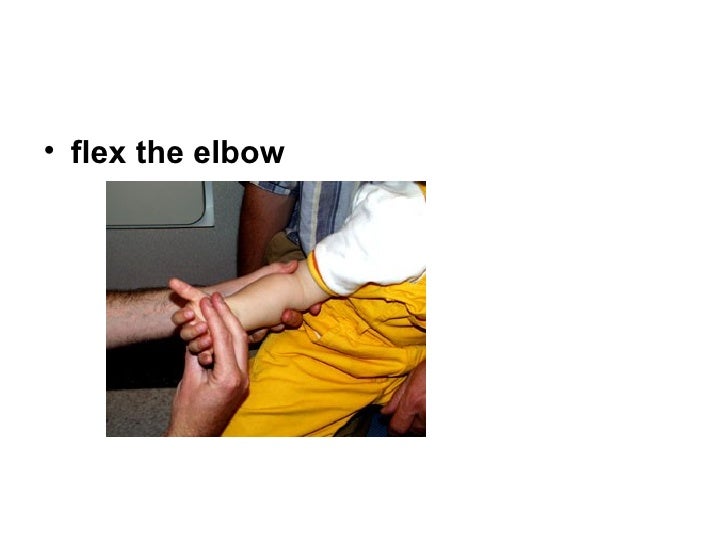 Pulled elbow