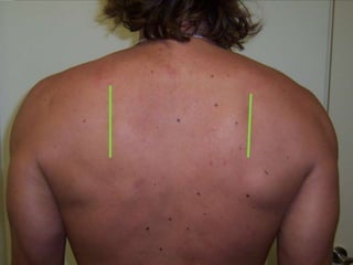 Pulling Movements – Shoulder Or Elbow First