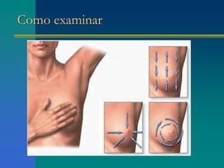 Como examinar
 