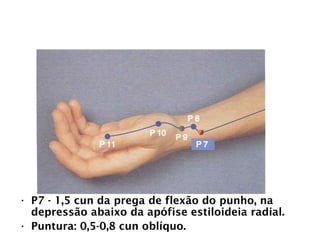 PULMÃO
• P7 - 1,5 cun da prega de flexão do punho, na
depressão abaixo da apófise estiloideia radial.
• Puntura: 0,5-0,8 cun oblíquo.
 