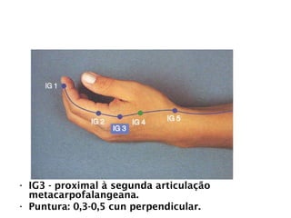 INTESTINO GROSSO
• IG3 - proximal à segunda articulação
metacarpofalangeana.
• Puntura: 0,3-0,5 cun perpendicular.
 