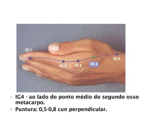 INTESTINO GROSSO
• IG4 - ao lado do ponto médio do segundo osso
metacarpo.
• Puntura: 0,5-0,8 cun perpendicular.
 