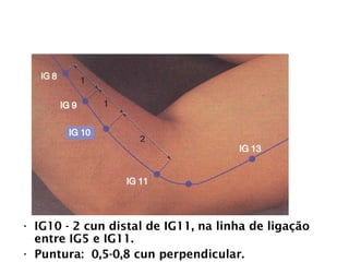 INTESTINO GROSSO
• IG10 - 2 cun distal de IG11, na linha de ligação
entre IG5 e IG11.
• Puntura: 0,5-0,8 cun perpendicular.
 