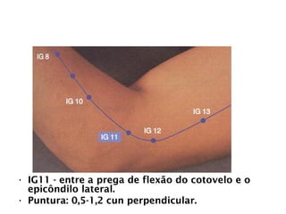 INTESTINO GROSSO
• IG11 - entre a prega de flexão do cotovelo e o
epicôndilo lateral.
• Puntura: 0,5-1,2 cun perpendicular.
 