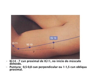 INTESTINO GROSSO
• IG14 - 7 cun proximal de IG11, no início do músculo
deltóide.
• Puntura: 0,5-0,8 cun perpendicular ou 1-1,5 cun oblíqua
proximal.
 