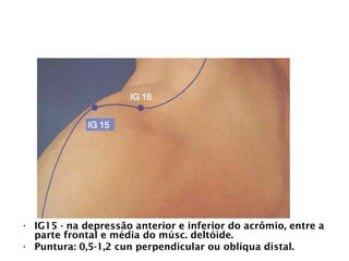 INTESTINO GROSSO
• IG15 - na depressão anterior e inferior do acrômio, entre a
parte frontal e média do músc. deltóide.
• Puntura: 0,5-1,2 cun perpendicular ou oblíqua distal.
 
