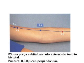 PULMÃO
• P5 - na prega cubital, ao lado externo do tendão
biciptal.
• Puntura: 0,5-0,8 cun perpendicular.
 
