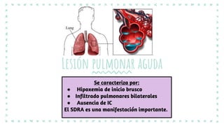Se caracteriza por:
● Hipoxemia de inicio brusco
● Infiltrado pulmonares bilaterales
● Ausencia de IC
El SDRA es una manifestación importante.
Lesión pulmonar aguda
 