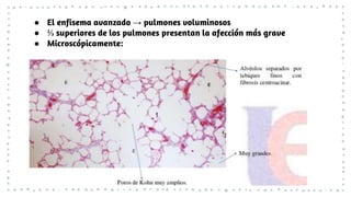 ● El enfisema avanzado → pulmones voluminosos
● ⅔ superiores de los pulmones presentan la afección más grave
● Microscópicamente:
 