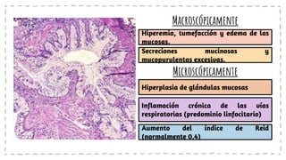 Hiperplasia de glándulas mucosas
Inflamación crónica de las vías
respiratorias (predominio linfocitario)
Aumento del índice de Reid
(normalmente 0.4)
Hiperemia, tumefacción y edema de las
mucosas.
Secreciones mucinosas y
mucopurulentas excesivas.
Macroscópicamente
Microscópicamente
 