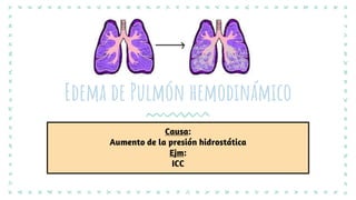 Causa:
Aumento de la presión hidrostática
Ejm:
ICC
Edema de Pulmón hemodinámico
 