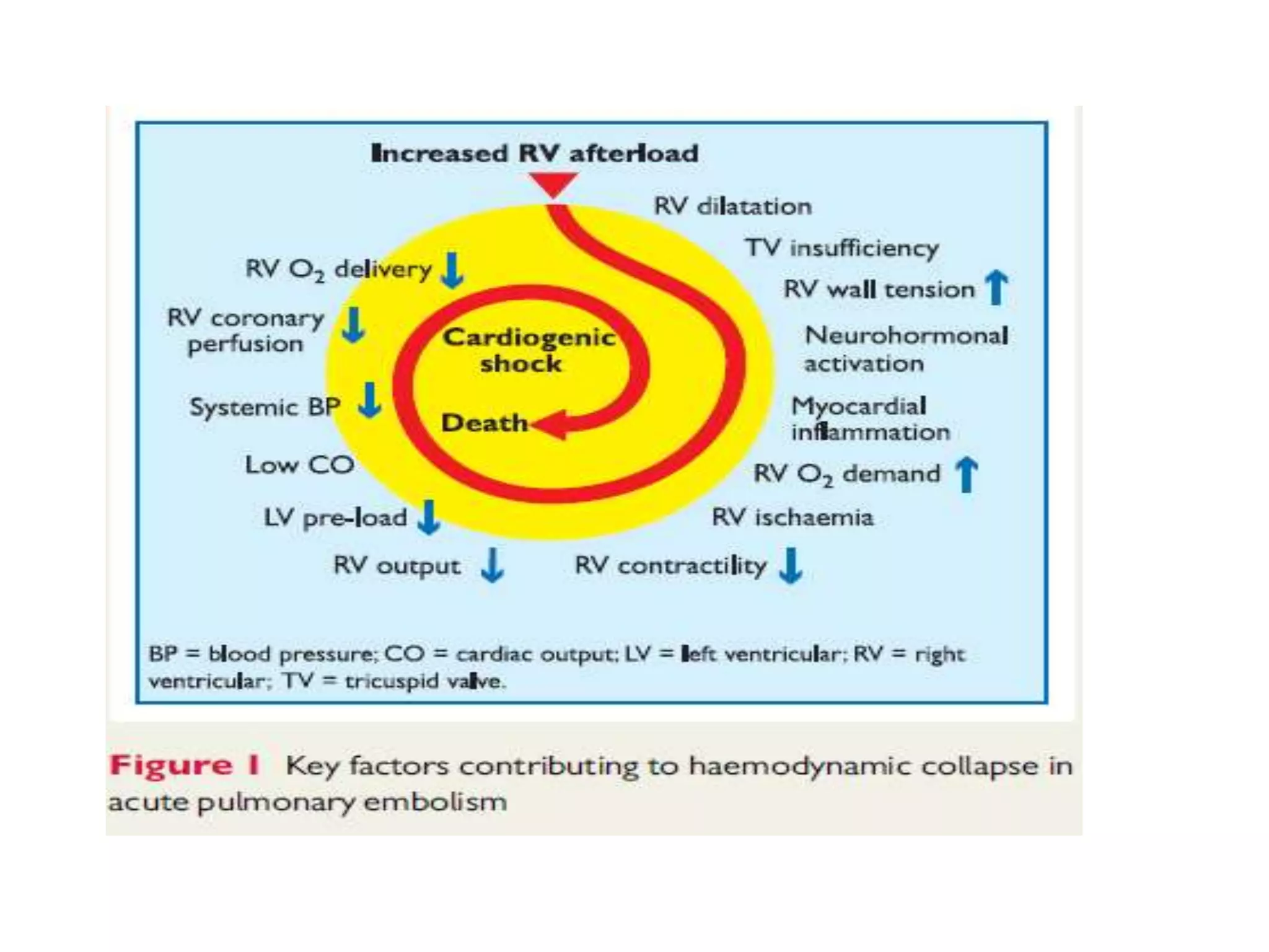 Pulmonary embolism | PPTX