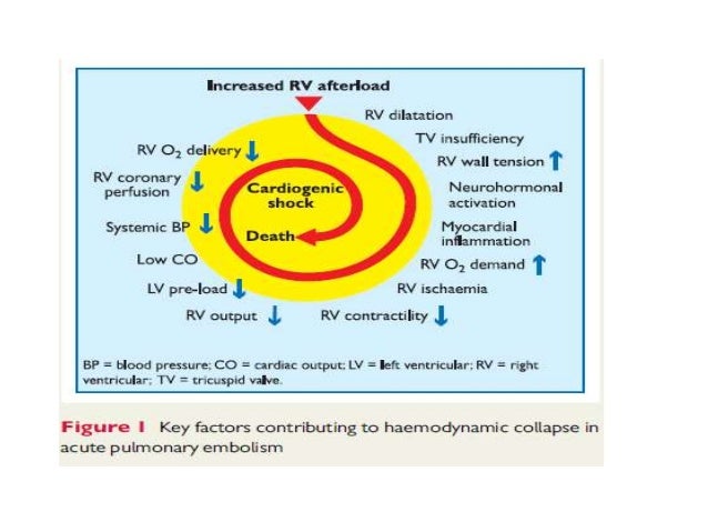 pulmonary embolism define pulmonary embolism