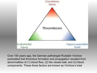 Vipoma Triad Pulmonari embolism | PPT