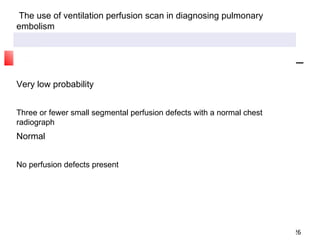 The use of ventilation perfusion scan in diagnosing pulmonary embolism Very low probability Three or fewer small segmental perfusion defects with a normal chest radiograph Normal No perfusion defects present 