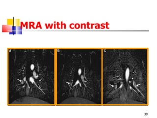MRA with contrast 