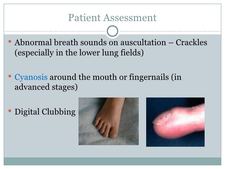 pulmonary fibrosis presentation pulmonary fibrosis presentation, Presentation templates