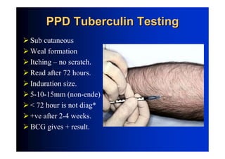 Pulmonary Tuberculosis | PDF