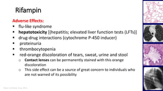 Marc Imhotep Cray, M.D.
Rifampin
Adverse Effects:
 flu-like syndrome
 hepatotoxicity [(hepatitis; elevated liver function tests (LFTs)]
 drug-drug interactions (cytochrome P-450 inducer)
 proteinuria
 thrombocytopenia
 red-orange discoloration of tears, sweat, urine and stool
o Contact lenses can be permanently stained with this orange
discoloration
o This side effect can be a source of great concern to individuals who
are not warned of its possibility
 