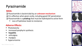 Marc Imhotep Cray, M.D.
Pyrazinamide
22
MOA:
 Pyrazinamide is bactericidal by an unknown mechanism
 It is effective when given orally, including good CSF penetration
 Pyrazinamide is a prodrug that must be hydrolyzed to active form
 Loss of hydrolase leads to resistance
Adverse Effects:
 Phototoxicity
 increased porphyrin synthesis
 hepatitis
 arthralgias
 myalgias
 hyperuricemia
 