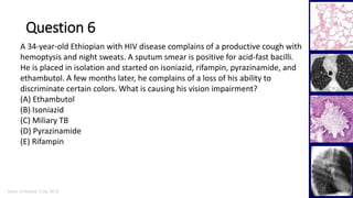 Marc Imhotep Cray, M.D.
Question 6
37
A 34-year-old Ethiopian with HIV disease complains of a productive cough with
hemoptysis and night sweats. A sputum smear is positive for acid-fast bacilli.
He is placed in isolation and started on isoniazid, rifampin, pyrazinamide, and
ethambutol. A few months later, he complains of a loss of his ability to
discriminate certain colors. What is causing his vision impairment?
(A) Ethambutol
(B) Isoniazid
(C) Miliary TB
(D) Pyrazinamide
(E) Rifampin
 