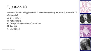 Marc Imhotep Cray, M.D.
Question 10
45
Which of the following side effects occurs commonly with the administration
of rifampin?
(A) Liver failure
(B) Renal failure
(C) Orange discoloration of secretions
(D) Anemia
(E) Leukopenia
 