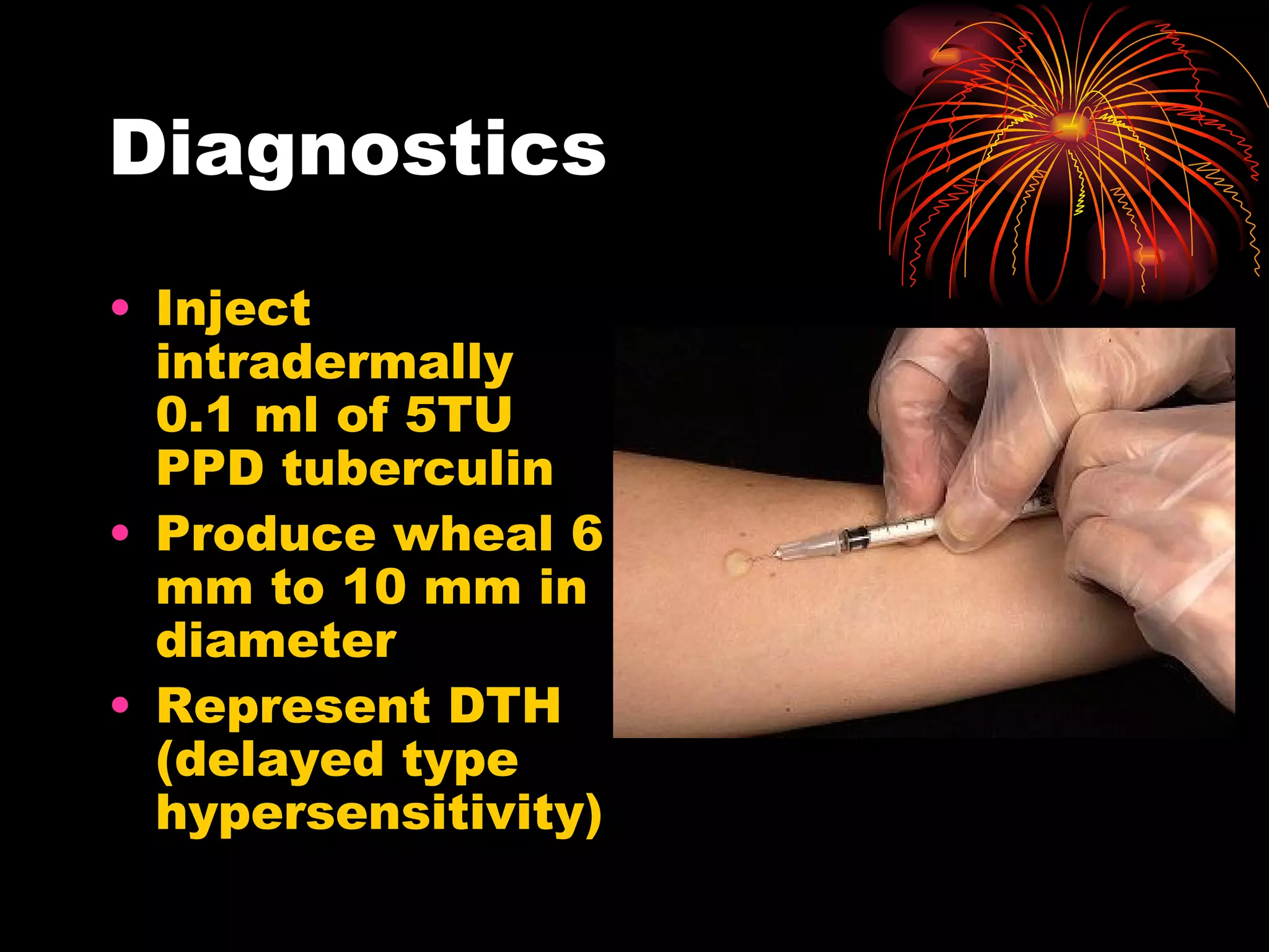 Diagnostics Inject intradermally 0.1 ml   of 5TU PPD tuberculin Produce wheal 6 mm to 10   mm in diameter Represent DTH  (delayed type hypersensitivity) 