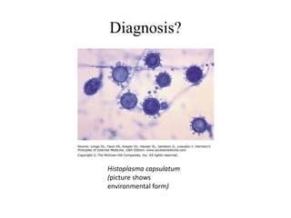Diagnosis?
Histoplasma capsulatum
(picture shows
environmental form)
 