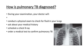 Pulmonary%20tuberculosis.pptx