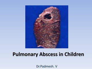 Pulmonary Abscess in Children
Dr.Padmesh. V
 