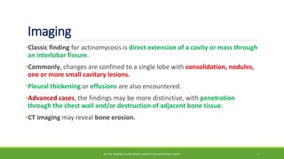 Imaging
•Classic finding for actinomycosis is direct extension of a cavity or mass through
an interlobar fissure.
•Commonly, changes are confined to a single lobe with consolidation, nodules,
one or more small cavitary lesions.
•Pleural thickening or effusions are also encountered.
•Advanced cases, the findings may be more distinctive, with penetration
through the chest wall and/or destruction of adjacent bone tissue.
•CT imaging may reveal bone erosion.
DR. MD. SHAFIQUL ISLAM DEWAN, RESIDENT (PULMONOLOGY), DMCH 7
 