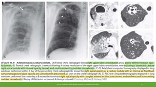 DR. MD. SHAFIQUL ISLAM DEWAN, RESIDENT (PULMONOLOGY), DMCH 9
 