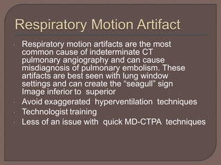  Respiratory motion artifacts are the most
common cause of indeterminate CT
pulmonary angiography and can cause
misdiagnosis of pulmonary embolism. These
artifacts are best seen with lung window
settings and can create the “seagull” sign
Image inferior to superior
 Avoid exaggerated hyperventilation techniques
 Technologist training
 Less of an issue with quick MD-CTPA techniques
 