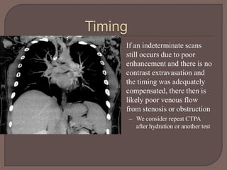 • If an indeterminate scans
still occurs due to poor
enhancement and there is no
contrast extravasation and
the timing was adequately
compensated, there then is
likely poor venous flow
from stenosis or obstruction
– We consider repeat CTPA
after hydration or another test
 