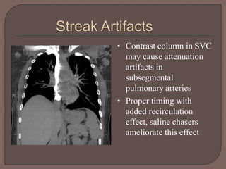 • Contrast column in SVC
may cause attenuation
artifacts in
subsegmental
pulmonary arteries
• Proper timing with
added recirculation
effect, saline chasers
ameliorate this effect
 