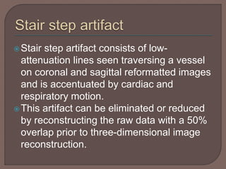 Stair step artifact consists of low-
attenuation lines seen traversing a vessel
on coronal and sagittal reformatted images
and is accentuated by cardiac and
respiratory motion.
This artifact can be eliminated or reduced
by reconstructing the raw data with a 50%
overlap prior to three-dimensional image
reconstruction.
 