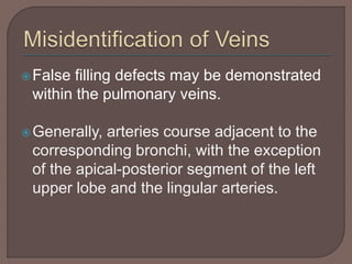 False filling defects may be demonstrated
within the pulmonary veins.
Generally, arteries course adjacent to the
corresponding bronchi, with the exception
of the apical-posterior segment of the left
upper lobe and the lingular arteries.
 