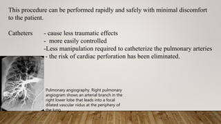 This procedure can be performed rapidly and safely with minimal discomfort
to the patient.
Catheters - cause less traumatic effects
- more easily controlled
-Less manipulation required to catheterize the pulmonary arteries
- the risk of cardiac perforation has been eliminated.
Pulmonary angiography. Right pulmonary
angiogram shows an arterial branch in the
right lower lobe that leads into a focal
dilated vascular nidus at the periphery of
the lung.
 