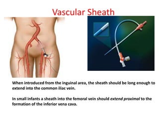 Vascular Sheath
When introduced from the inguinal area, the sheath should be long enough to
extend into the common iliac vein.
In small infants a sheath into the femoral vein should extend proximal to the
formation of the inferior vena cava.
 