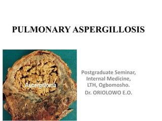 PULMONARY ASPERGILLOSIS
Postgraduate Seminar,
Internal Medicine,
LTH, Ogbomosho.
Dr. ORIOLOWO E.O.
 