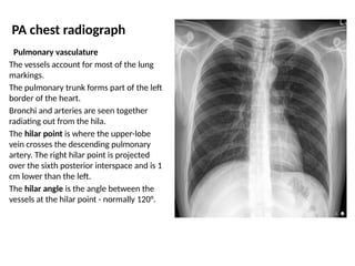 PULMONARY CIRCULATION including anatomy.pptx